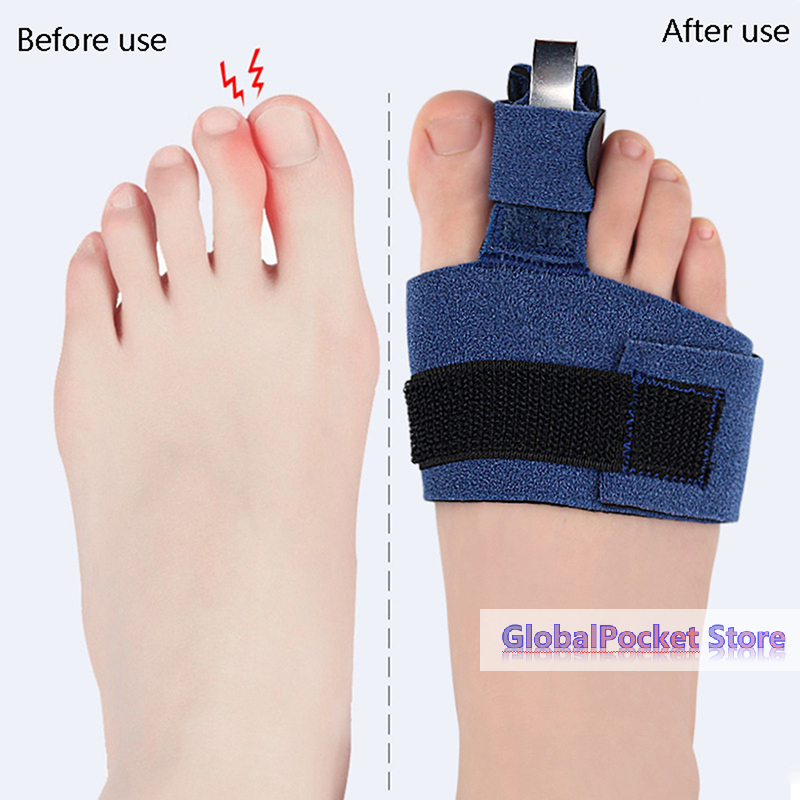 1Pcs Toe Corrector Toe Fractur - مراجعة Ankle Brace Sock وسعره